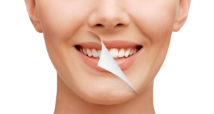 Cosmetics Teeth Whitening